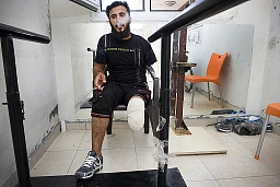 Ibrahim Tamer (24) Jabhat Islamiya fighter waiting for a prosthetic leg.